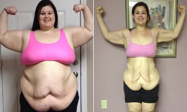 400 lb Girl Lost Half Her Weight In One Year, But Her Final Transformation  Will Shock You! – InspireMore