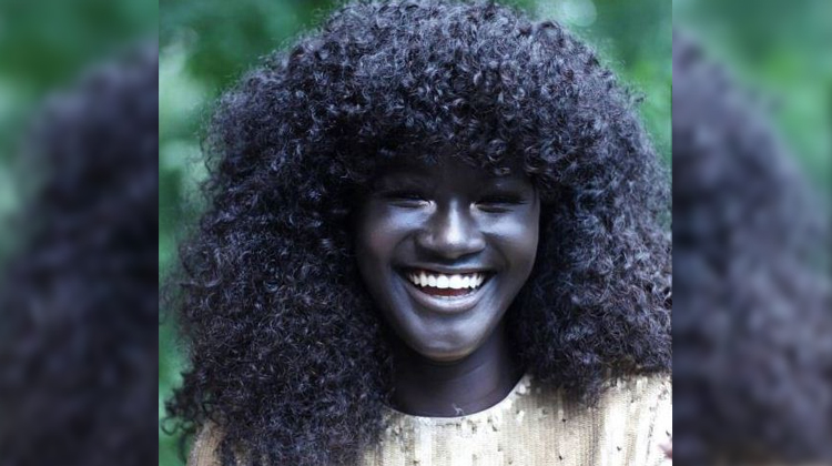 Teen Bullied For Stunning Skin Tone Becomes Model And Takes Instagram By Storm Inspiremore 