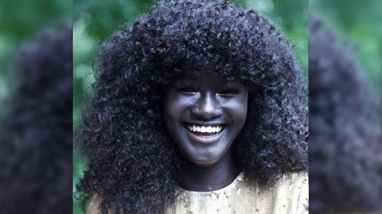 Teen Bullied For Stunning Skin Tone Becomes Model And Takes Instagram By Storm Inspiremore