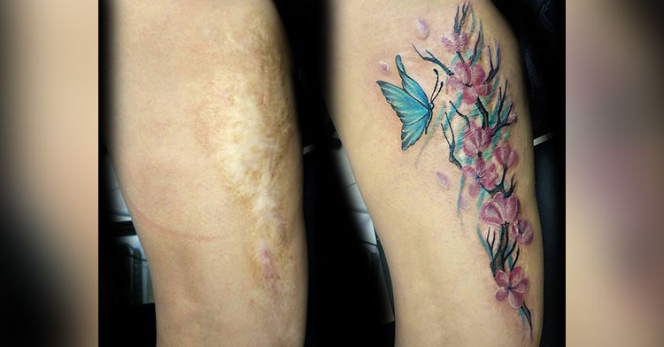 Freehand scar cover up. ♥️ As long as the scar is 3+ years old, I love  creating a piece that helps you feel beautiful and comfortabl... | Instagram