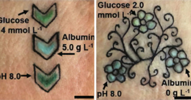 Tattoos in medicine | Recipe