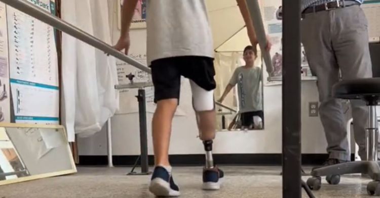 Saleh walks on prosthetic leg