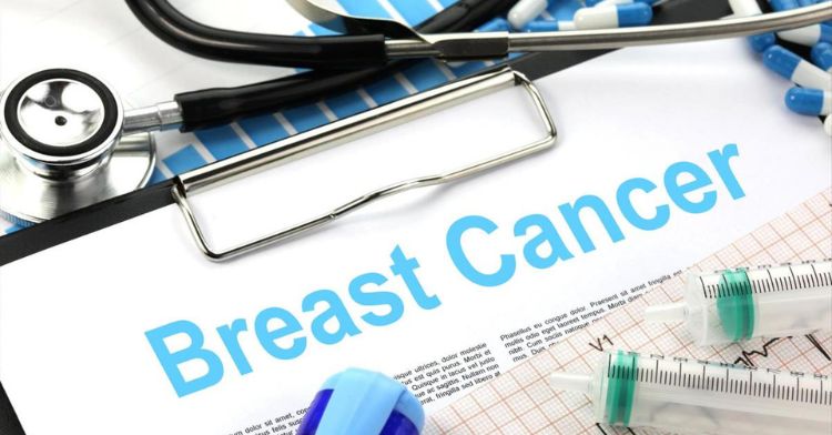 "A Major Step Forward" New Breast Cancer Prevention Drug To Be Offered ...