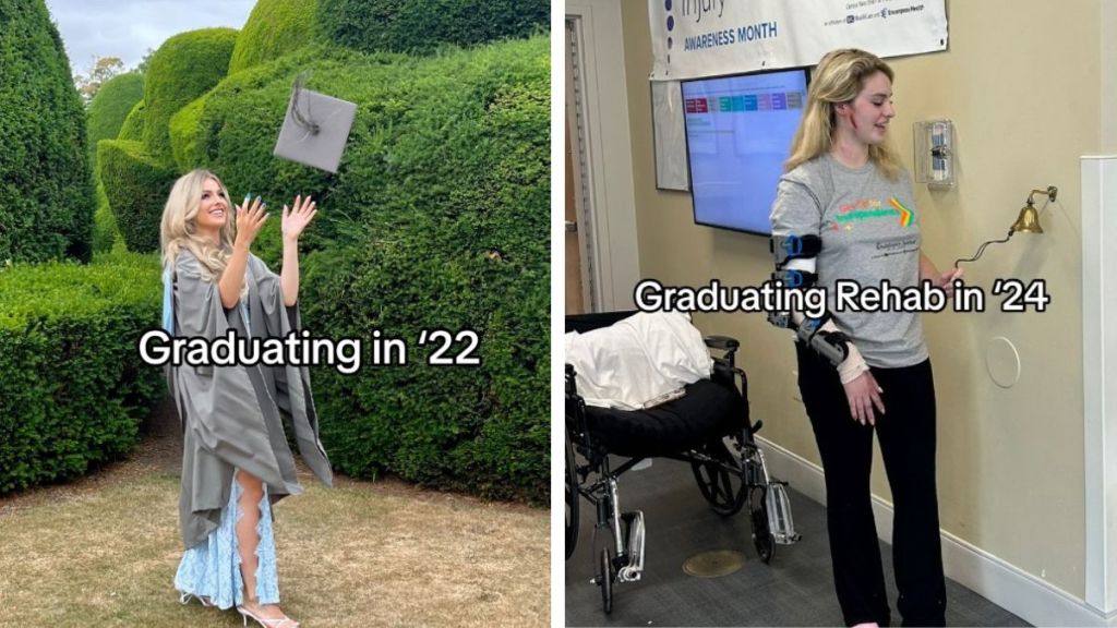 Image shows Ellie Bentley after her 2022 graduation from University of York. Right image shows Ellie Bentley after surviving a shooting and hit-and-run car accident graduating from rehab.