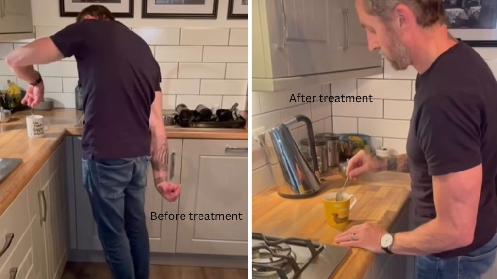 Left image shows a person struggling to make a cup of coffee. Right image shows the same patient after a new Parkinson's treatment gives him greater control over the disease allowing him to function almost normally.