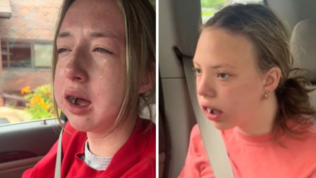 Ruby (left image) and Lily (right image) sitting in the family car having different reactions to the anesthesia on their way home after wisdom teeth removal.