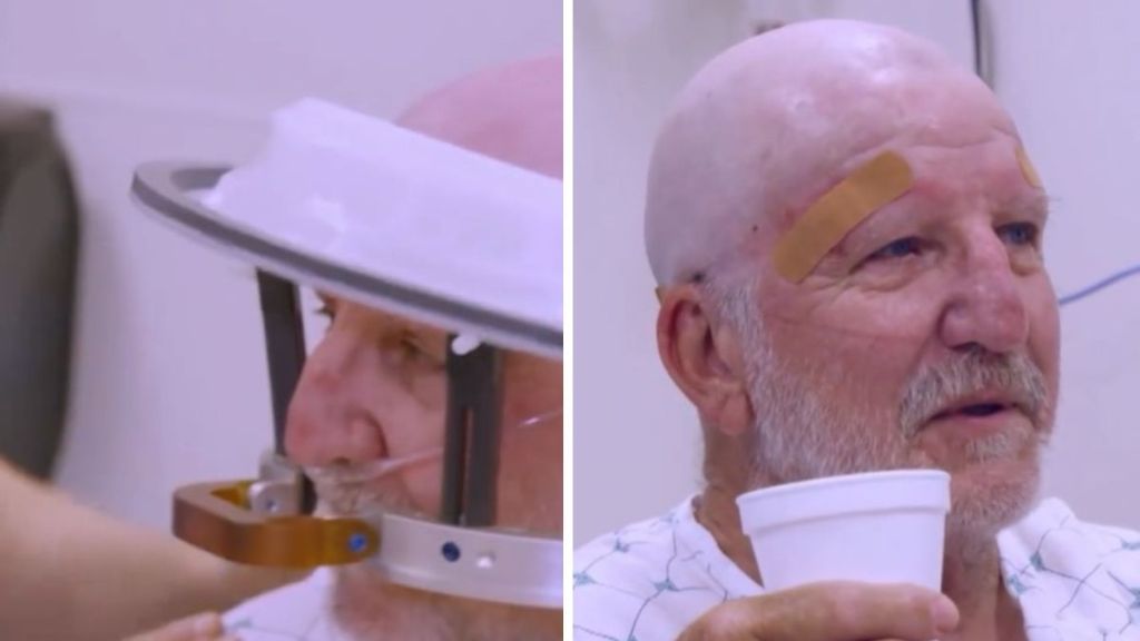 Left image shows a man wearing a halo assembly used during treatment for essential tremor. Right image shows the man smiling, and not having tremors, after the procedure.