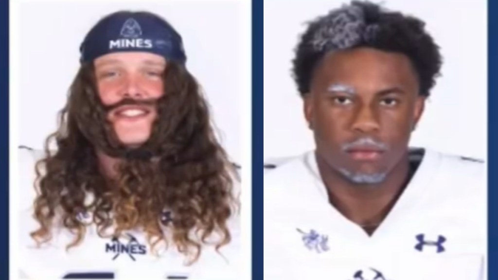 A two-photo collage. Both show headshots of football players. The first has his long, curly hair is styled to look like a mustache and beard. The second has half his hair grey. This is also true of one eyebrow, his mustache, and beard